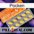 Poxet new05